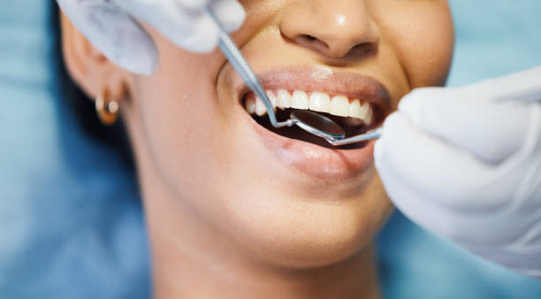 Best Emergency Gum Treatment in Del Mar, CA