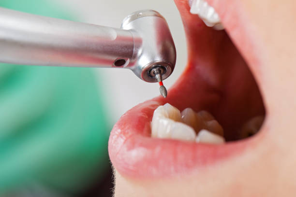 Best Pediatric Emergency Dentist in Del Mar, CA